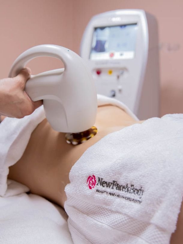 Lipoescultura No Invasiva con Radiofrecuencia en New Face & Body